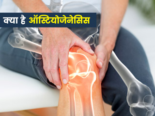 हड्डियों को कमजोर करने वाली बीमारी है ऑस्टियोजेनेसिस, जानें इसके लक्षण, प्रकार और इलाज