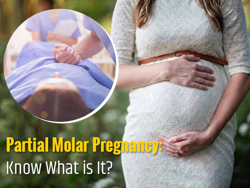 Partial Molar Pregnancy: Symptoms, Causes And Treatment