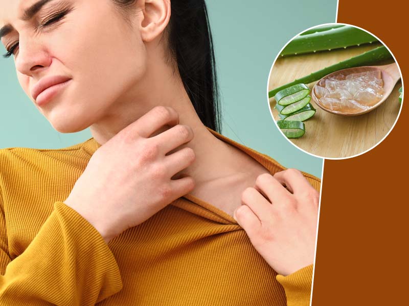 खुजली का घरेलू इलाज करें एलोवेरा से, जानें इसके इस्तेमाल के 5 तरीके