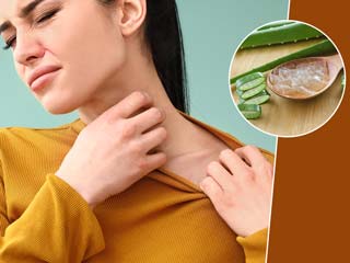 खुजली का घरेलू इलाज करें एलोवेरा से, जानें इसके इस्तेमाल के 5 तरीके