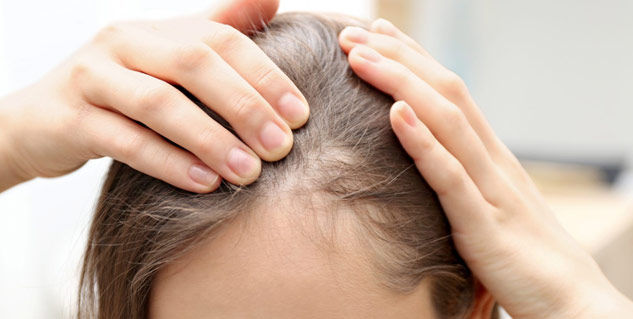 hair loss