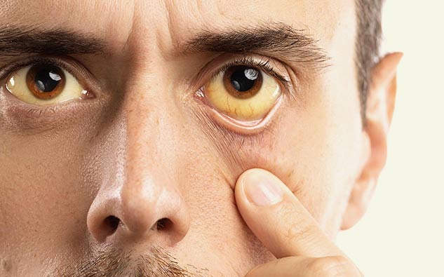 liver symptoms