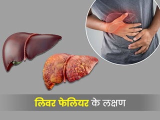 Liver Failure: लिवर फेलियर क्यों होता है और इसके क्या लक्षण हैं? डॉक्टर से जानें इससे बचाव के टिप्स