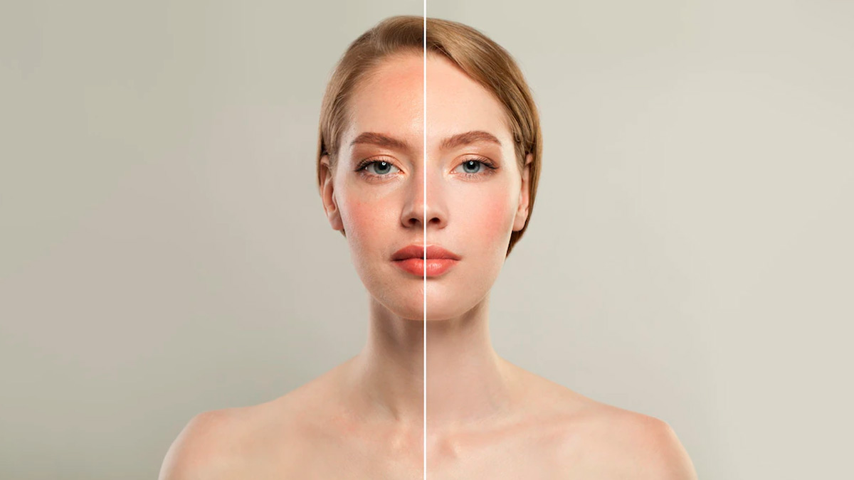 चेहरे की असमान रंगत (Uneven Skin Tone) को समान बनाने के लिए अपनाएं ये घरेलू उपाय