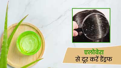 एलोवेरा से डैंड्रफ कैसे हटाएं? इन 4 तरीकों से करें इस्तेमाल