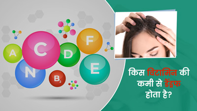 शरीर में इन 4 विटामिन्स की कमी से हो सकती है डैंड्रफ की समस्या