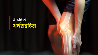 वायरल संक्रमण के कारण हो सकता है वायरल अर्थराइ‍ट‍िस, जानें कारण और इलाज  