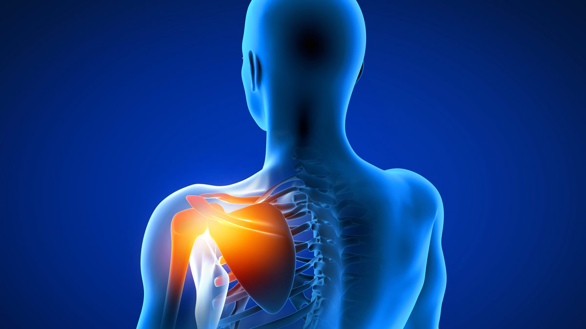 Shoulder arthritis treatment