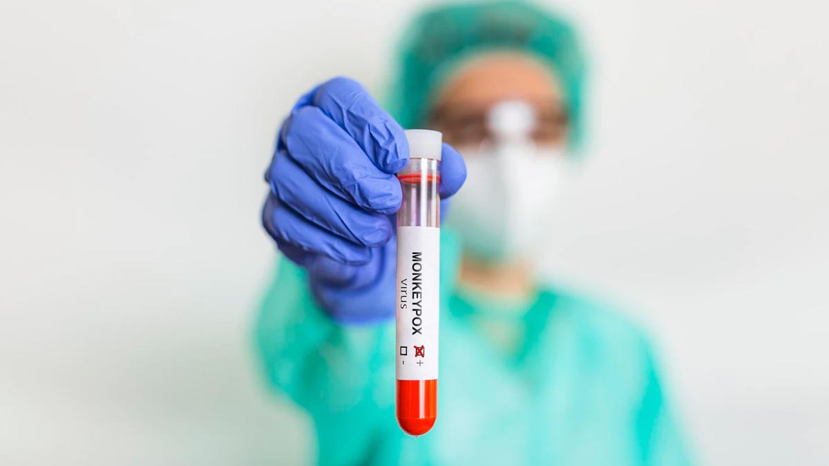 First Monkeypox Case in India Kerala