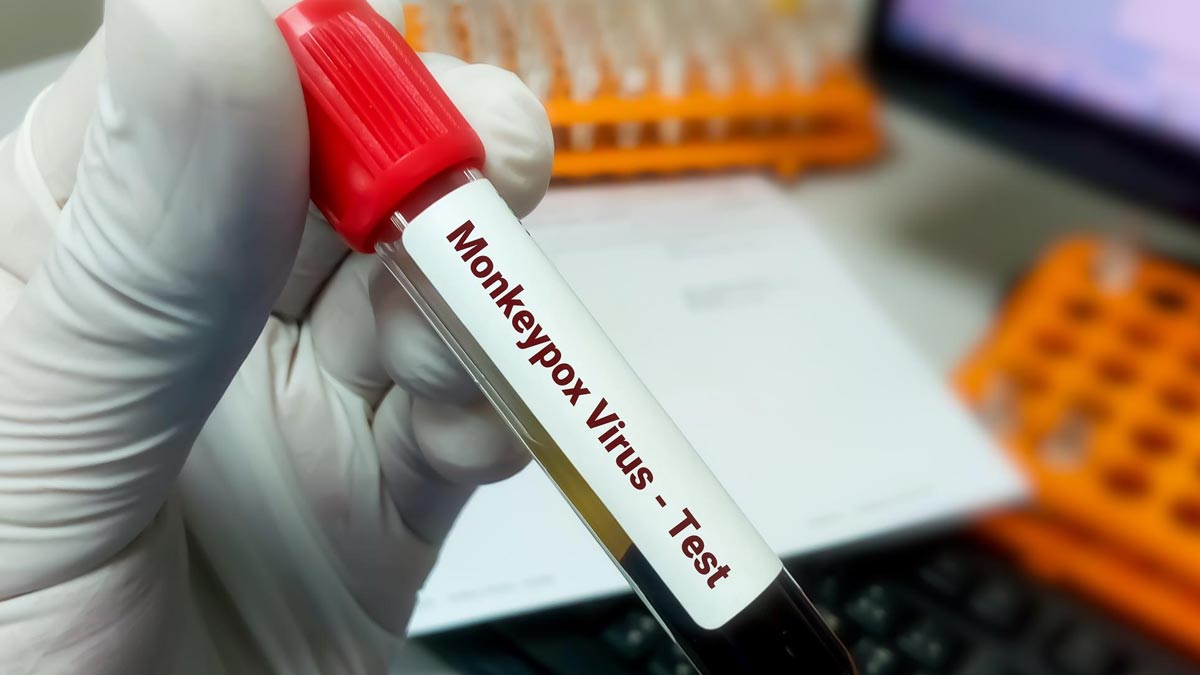 Monkeypox Case in India: भारत में आया मंकीपॉक्स का पहला मामला, UAE से केरल लौटा शख्स पॉजिटिव