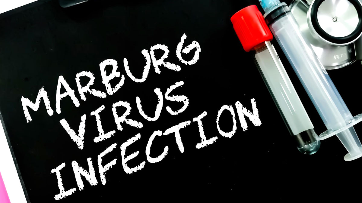 Ghana Declares Marburg Virus Outbreak, What Is It And Who Should Be Worried?