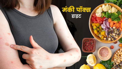 Monkey Pox Diet: मंकी पॉक्स होने पर तेज रिकवरी के लिए करना चाहिए इन फूड्स का सेवन