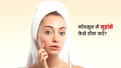 मॉनसून में हो गए हैं मुहांसे (Pimples), तो इन तरीकों से पाएं छुटकारा
