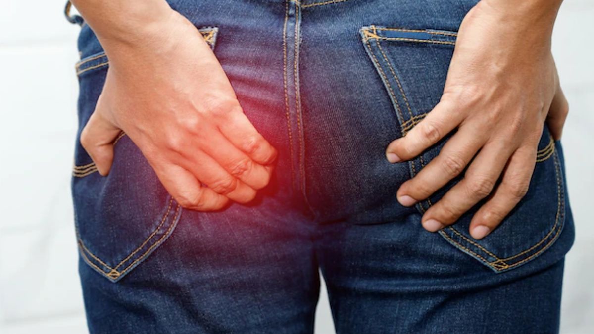 difference between fissure and piles