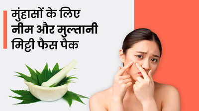 मुंहासे दूर करेगा नीम और मुल्तानी मिट्टी का फेस पैक, इस तरह करें इस्तेमाल
