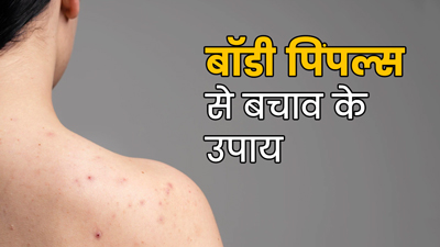 चेहरे की तरह आपकी बॉडी पर भी हो सकते हैं पिंपल्स, जानें बचाव के उपाय