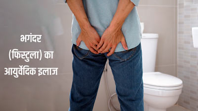 भगंदर (फिस्टुला) का आयुर्वेदिक इलाज जानें आयुर्वेदाचार्य से, मिलेगा आराम