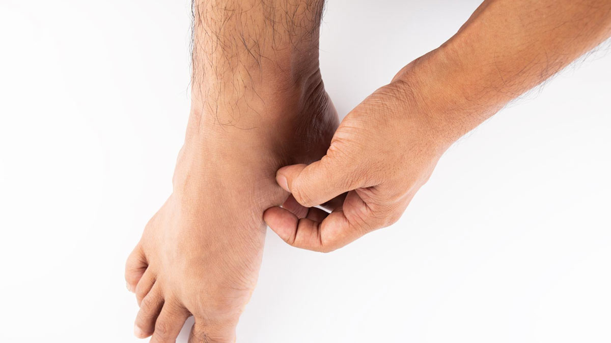 Home Remedies For Itchy Foot Sole In Hindi