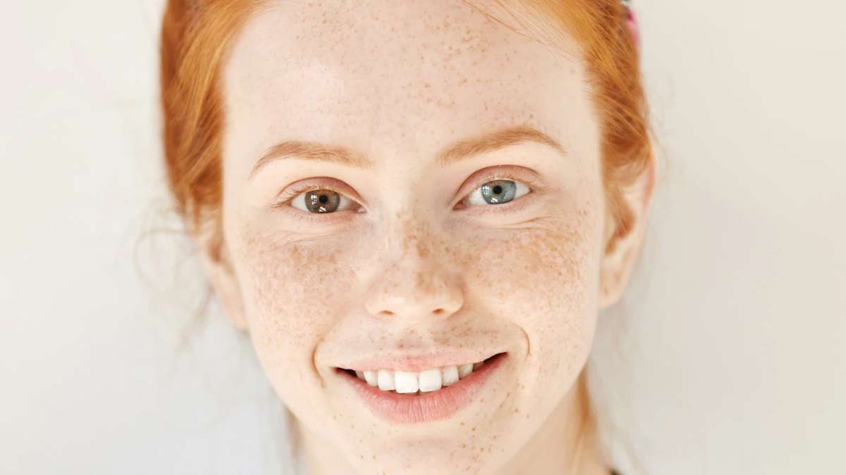 Jhaiyan Kis Vitamin ki kami se hoti hai