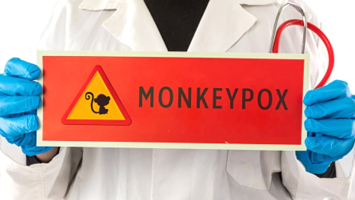 Monkeypox-Guideline-Issued-By-Govt