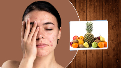 चेहरे के काले दाग-धब्बों (डार्क स्पॉट्स) को हटाने के लिए खाएं ये 5 फूड्स, त्वचा में आने लगेगा निखार