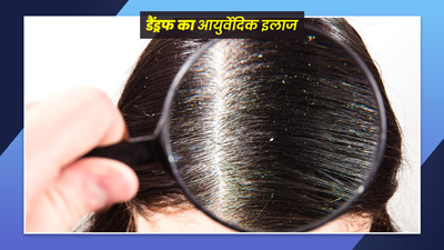 डैंड्रफ से छुटकारा पाना है तो करें इन आयुर्वेदिक नुस्खों का प्रयोग, जल्द मिलेगा छुटकारा