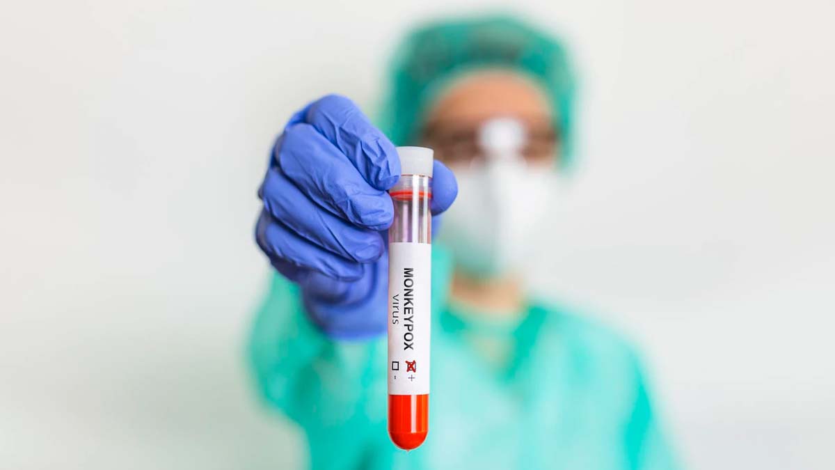 Monkeypox Cases in India