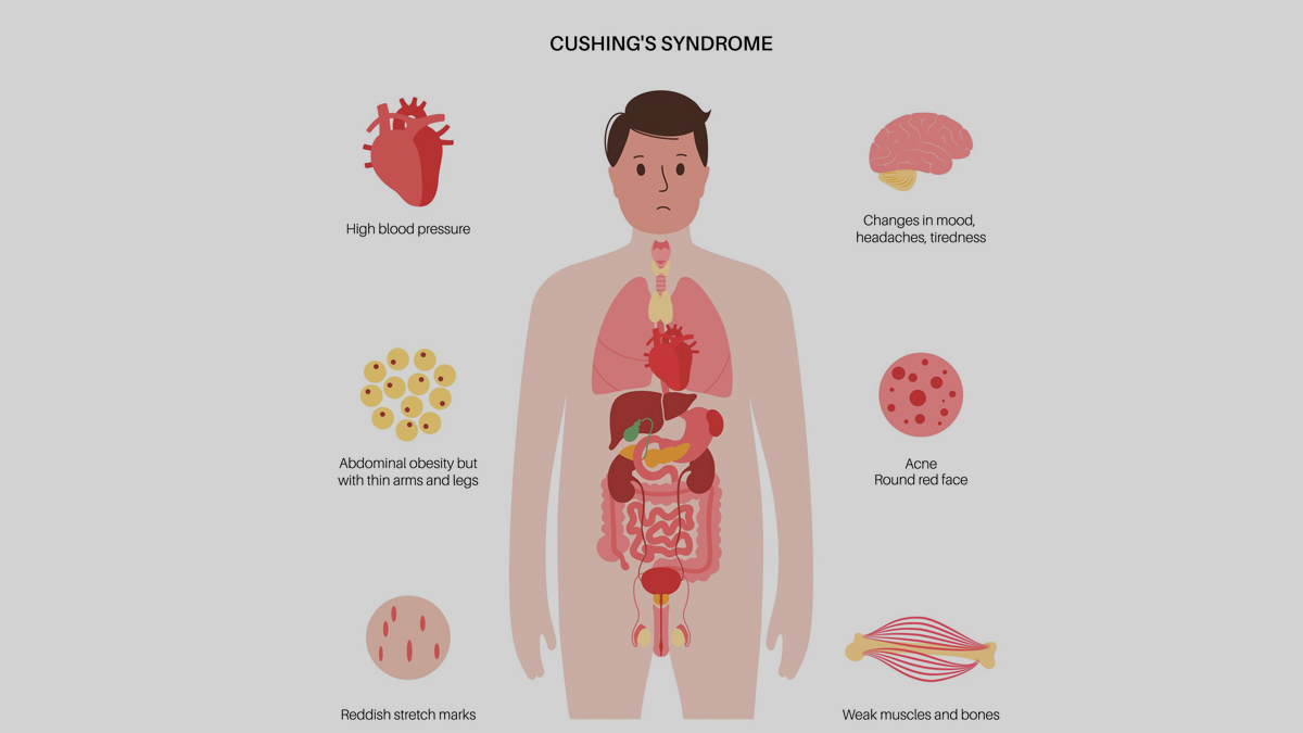side effects of steroids overuse
