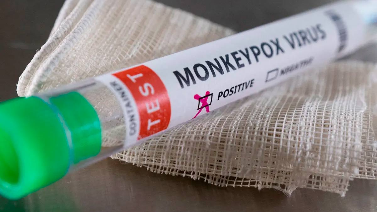 विश्व स्वास्थ्य नेटवर्क (WHN) ने मंकीपॉक्स को घोषित किया महामारी, 58 देशों में फैला संक्रमण
