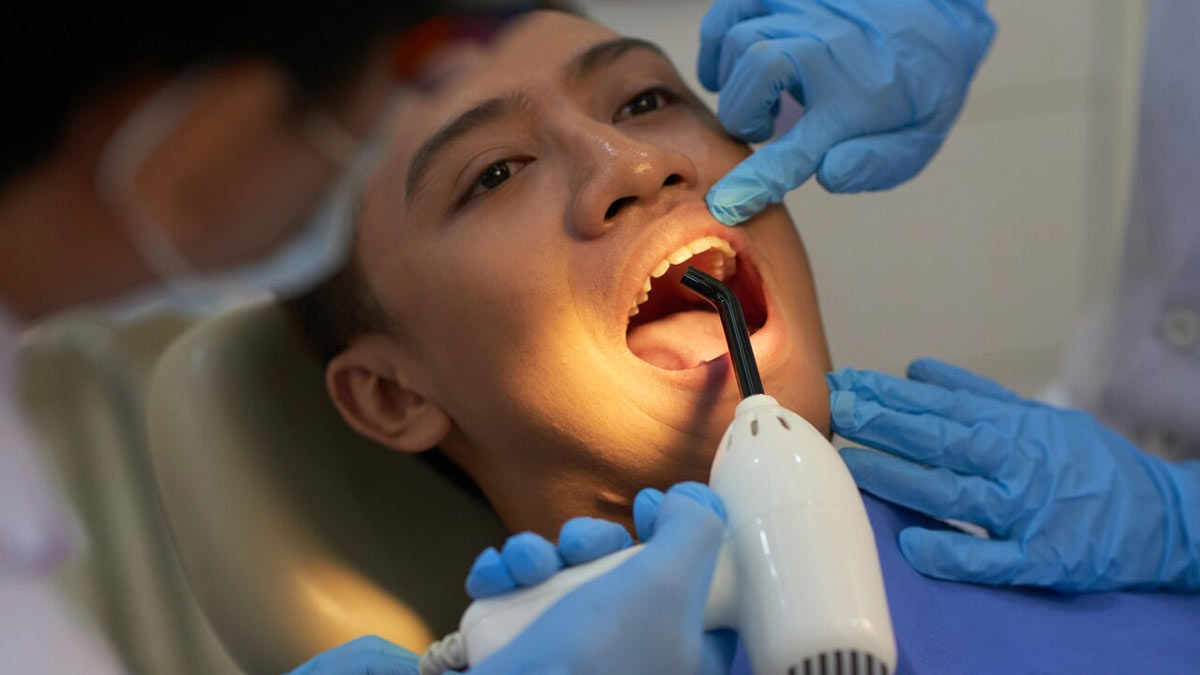 tooth-decay