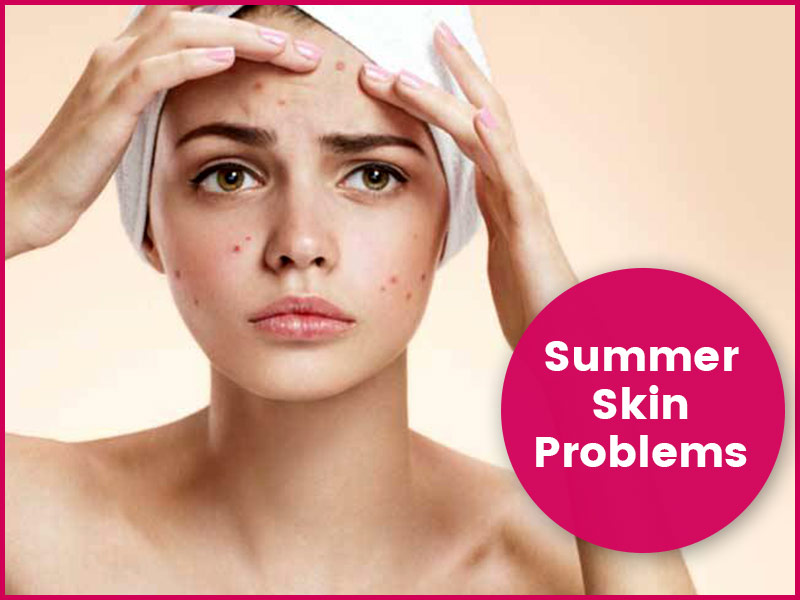 6 Common Skin Problems In Summers & How To Prevent