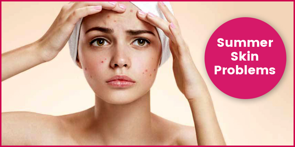 common-skin-problems-in-summers-how-to-prevent-onlymyhealth