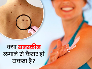 क्या सनस्क्रीन लगाने से हो सकता है स्किन कैंसर? जानें क्या कहते हैं एक्सपर्ट