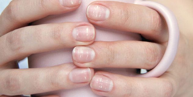 What Your Nails Can Tell You About Your Health