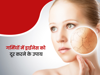 गर्मियों में चेहरे का रूखापन दूर करेंगे ये 7 घरेलू उपाय, ऑयली स्किन से भी मिलेगा छुटकारा