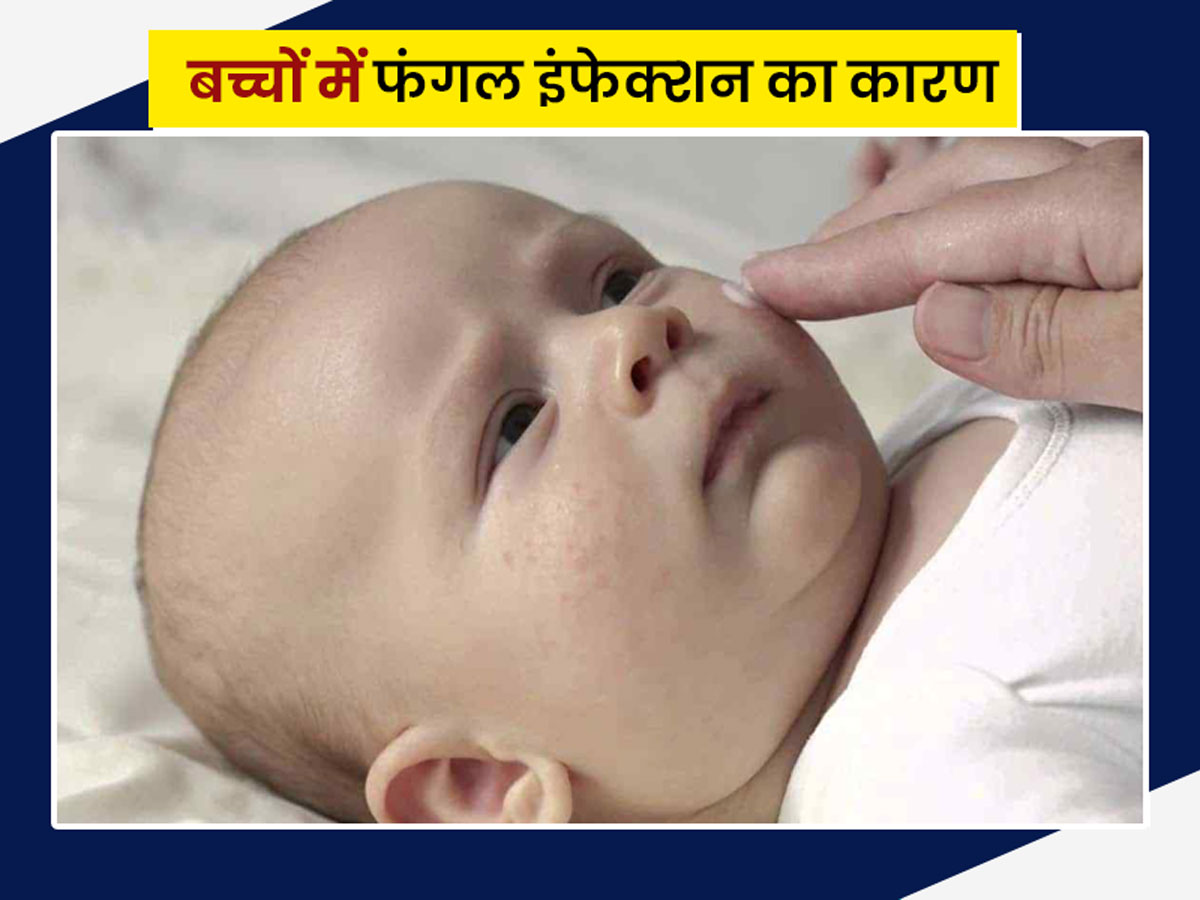 बच्चों में फंगल इंफेक्शन के कारण और बचाव के उपाय | Fungal Infection Causes  in Children in Hindi