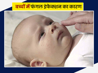 बच्चों में फंगल इंफेक्शन के क्या कारण होते हैं? डॉक्टर से जानें बचाव के उपाय