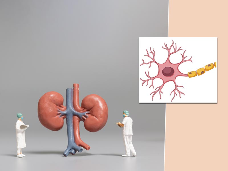Stem Cell Therapy Can Deal With Kidney Problems, Read Details Inside