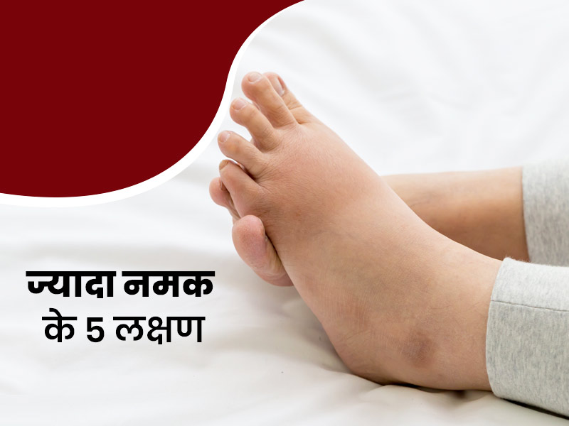 आप भी तो नहीं खाते ज्यादा नमक? एक्सपर्ट से जानें शरीर में ज्यादा नमक के 5 लक्षण