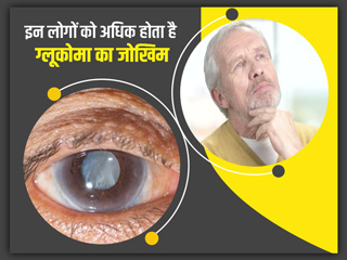ग्लूकोमा (काला मोतियाबिंद) का इन 6 तरह के लोगों को होता है ज्यादा खतरा, जानें इसके लक्षण और बचाव के उपाय