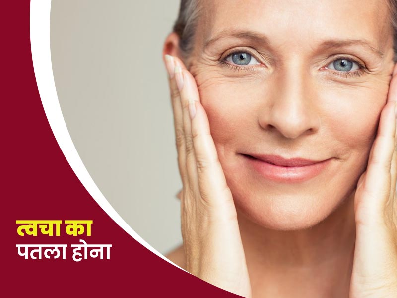 पतली त्वचा के कारण बाहर से नजर आती हैं नसें, जानें पतली त्वचा का कारण, लक्षण और ठीक करने के उपाय