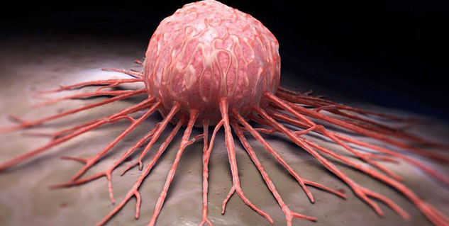 cancer treatment 