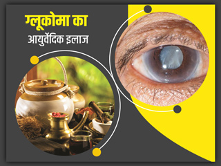 ग्लूकोमा (काला मोतिया) होने पर अपनाएं ये 4 आयुर्वेदिक उपाय, समस्या से मिल सकता है आराम