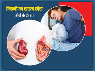 ये हैं किडनी का साइज छोटा होने के कारण और लक्षण, जानें कितना होता है किडनी का नॉर्मल साइज