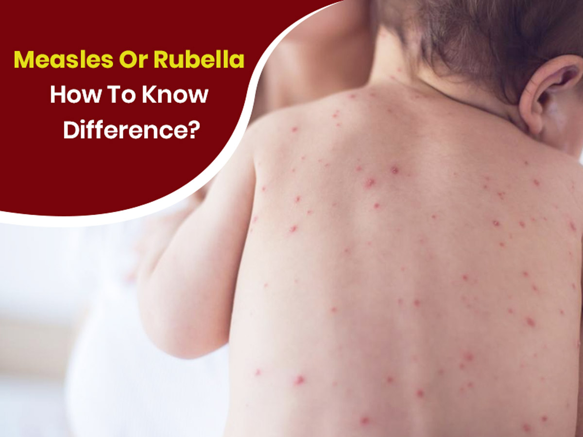 rubella vs rubeola rash