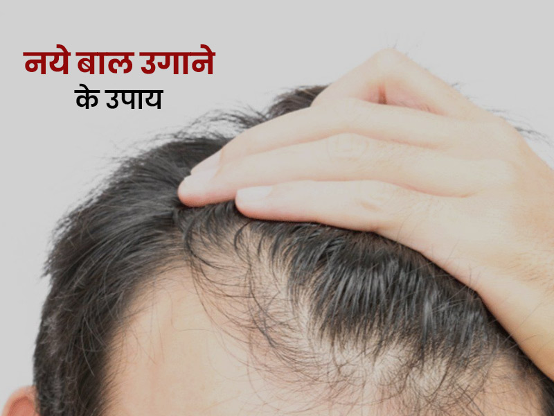 नये बाल उगाने के 5 घरेलू उपाय, जो दादी-नानी के समय से हैं कारगर | Nani ke  nuskhe How to regrow hair naturally in hindi