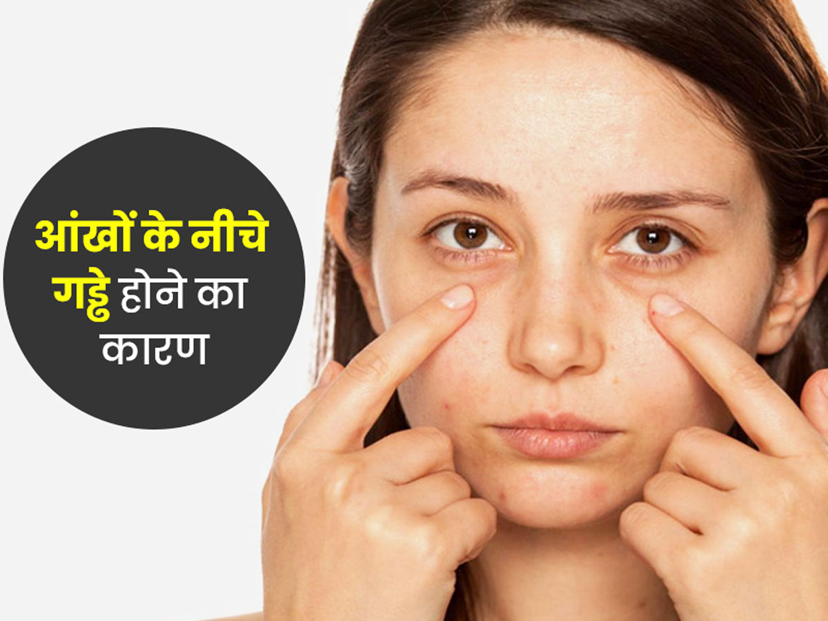 Sunken eyes causes home remedies in hindi | आंखों के नीचे गड्ढे के पीछे हो  सकते हैं ये 5 कारण, जानें उपाय | Onlymyhealth