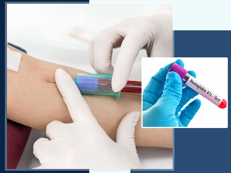 डायब‍िटीज में क्यों पड़ती है A1C टेस्‍ट करवाने की जरूरत? जानें इस टेस्ट के बारे में सभी जरूरी बातें