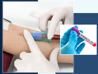 डायब‍िटीज में क्यों पड़ती है A1C टेस्‍ट करवाने की जरूरत? जानें इस टेस्ट के बारे में सभी जरूरी बातें