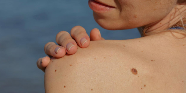 Malignant-Tumour-Prevention